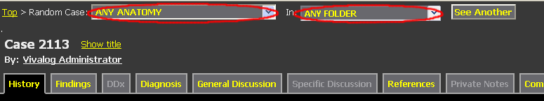 show dropdowns for constraining Random Case